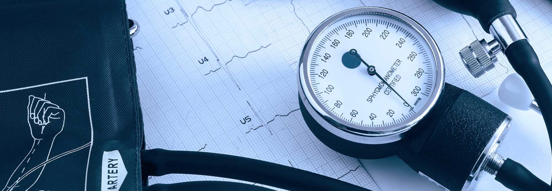 Nadciśnienie tętnicze - przyczyny, objawy i leczenie wysokiego ciśnienia krwi